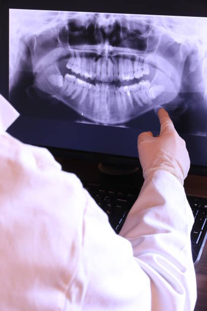 Best Emergency Dental Care for Broken or Chipped Teeth in Honea Path, SC